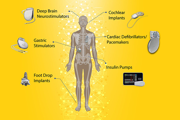 Medical Implants