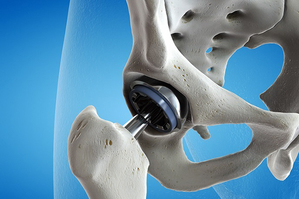 Orthopedic & Joint